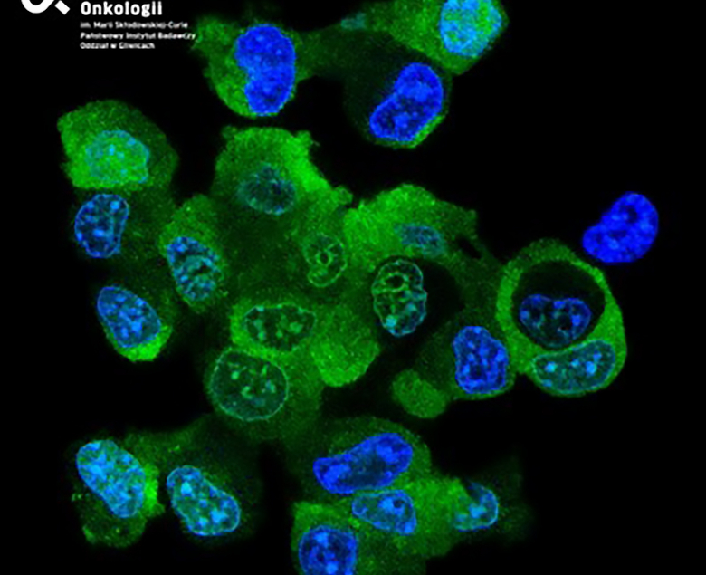 Hodowla 2D komórek nowotworowych czerniaka Autorka zdjecia Dr Magdalena Jarosz-Biej