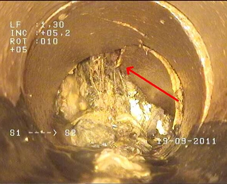 Uszkodzenie kanału poprzez przerost korzeniowy.